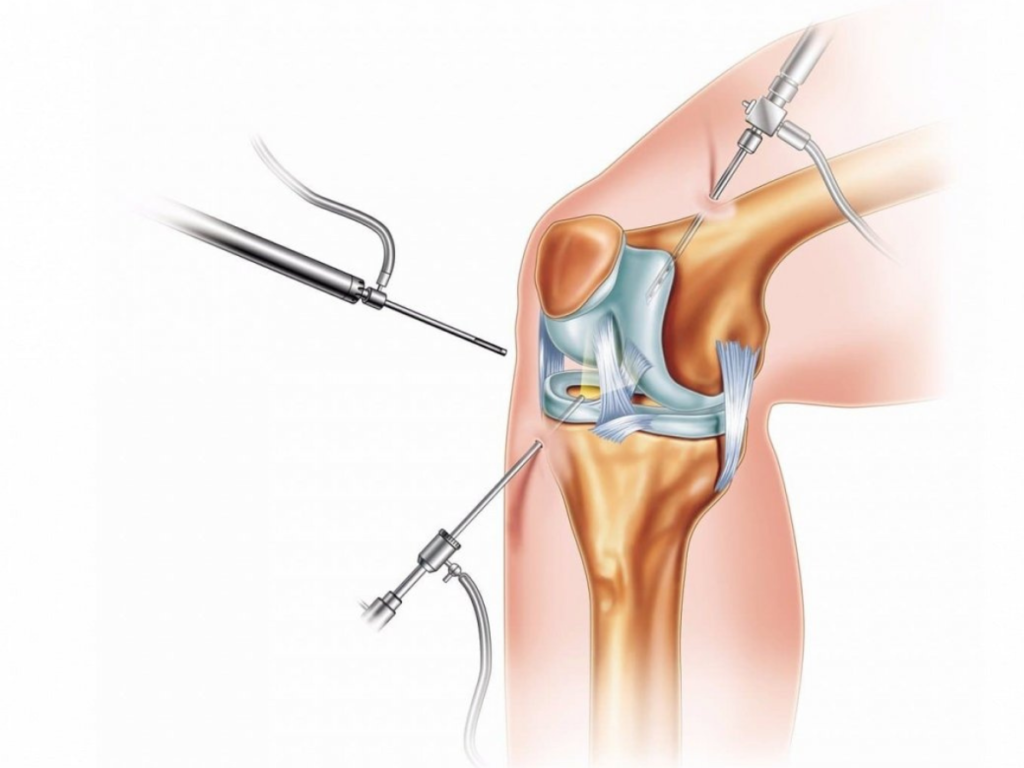 Knee Replacement Surgery Addressing Safety and Accuracy Concerns