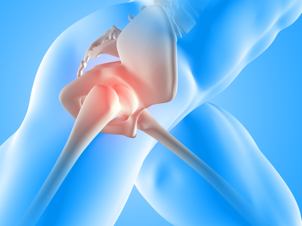 The Evolution of Knee Replacement Unveiling Muscle-Sparing Techniques