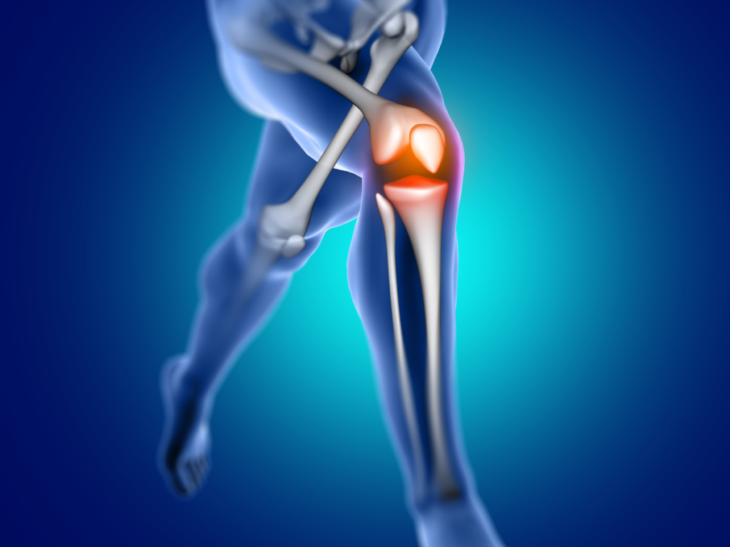 The Evolution of Knee Replacement Unveiling Muscle-Sparing Techniques