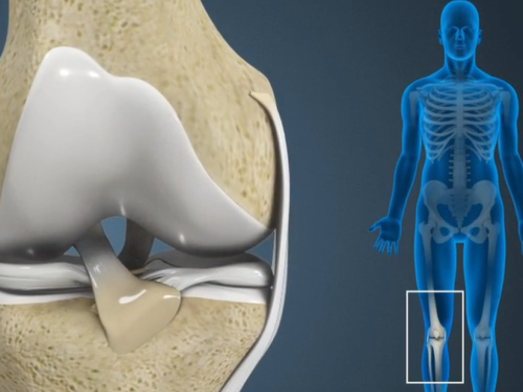 Explore the Stages of Rehabilitation After Multi-Ligament Surgery at Helios OrthoJoint