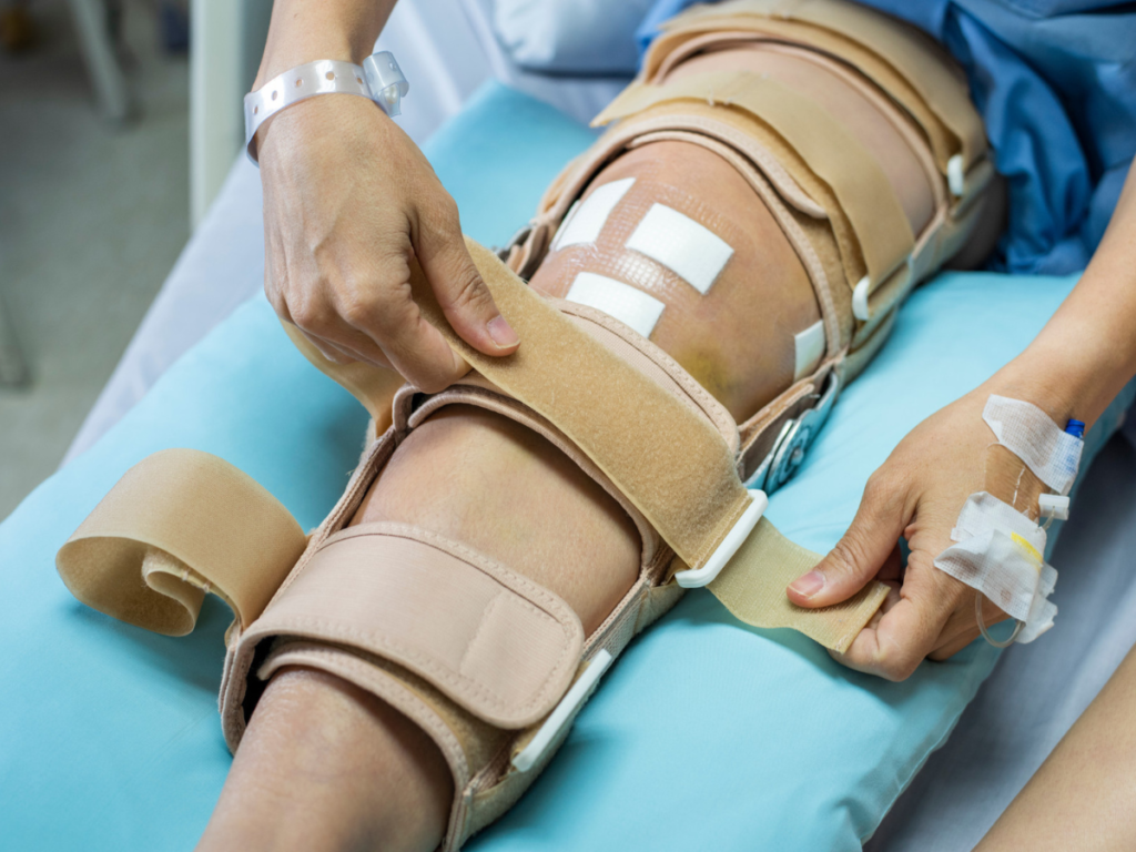 Navigating ACL Reconstruction Recovery: Essential Tips for a Seamless Rehabilitation