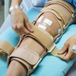 Navigating ACL Reconstruction Recovery: Essential Tips for a Seamless Rehabilitation