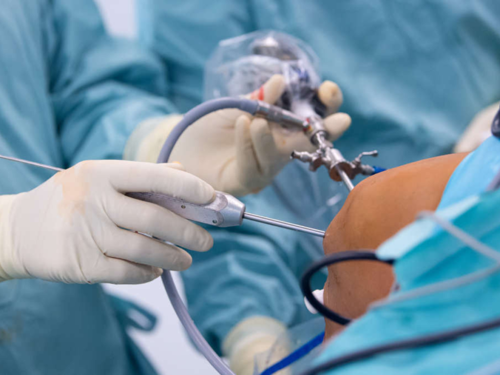 Exploring the Potential of Arthroscopic Surgery: Examining Orthopedic Conditions Closely.