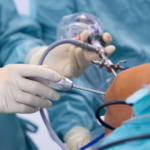 Exploring the Potential of Arthroscopic Surgery: Examining Orthopedic Conditions Closely.