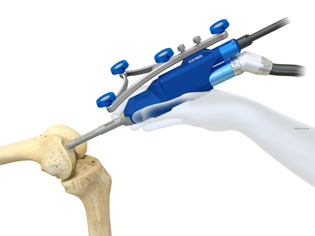 How Robotic Knee Replacement Improves Surgical Precision and Outcomes