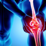 Explore the underlying causes of osteoarthritis and the latest treatment options available.